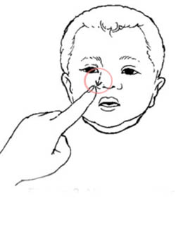 masaż kanalików łzowych u niemowląt